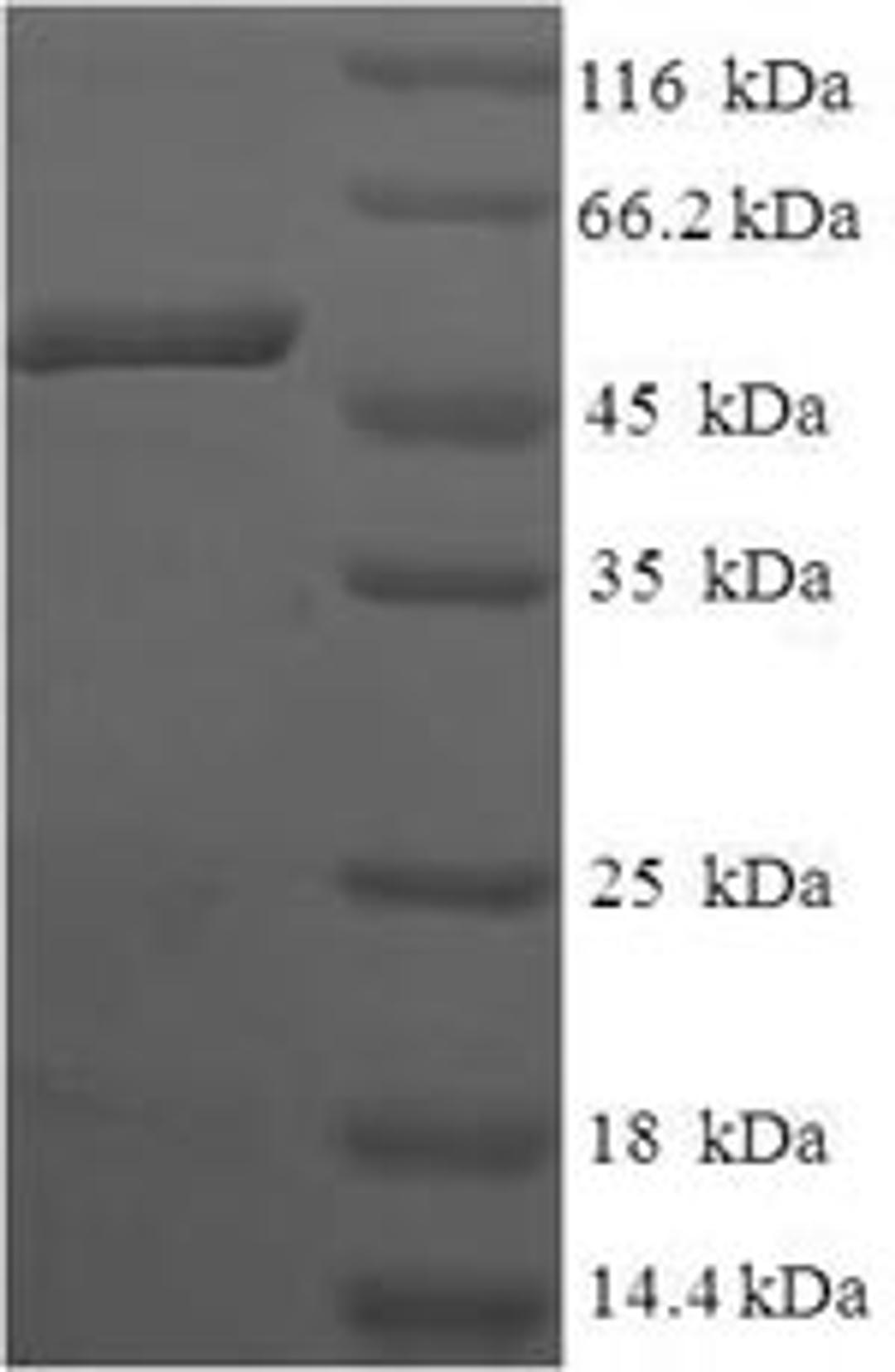(Tris-Glycine gel) Discontinuous SDS-PAGE (reduced) with 5% enrichment gel and 15% separation gel.