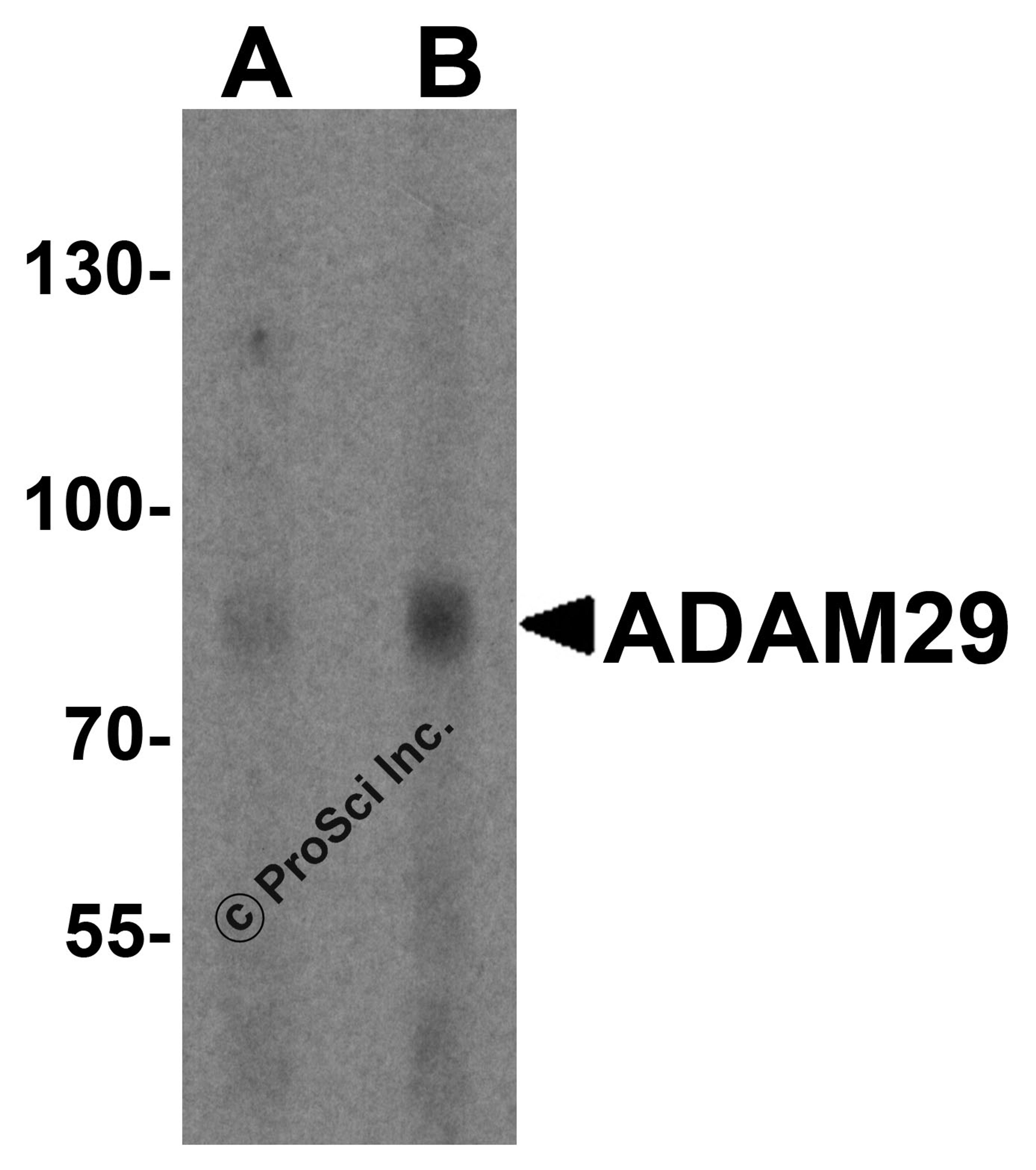 Western blot analysis of ADAM29 in human bladder tissue lysate with ADAM29 antibody at (A) 1 and (B) 2 μg/ml.