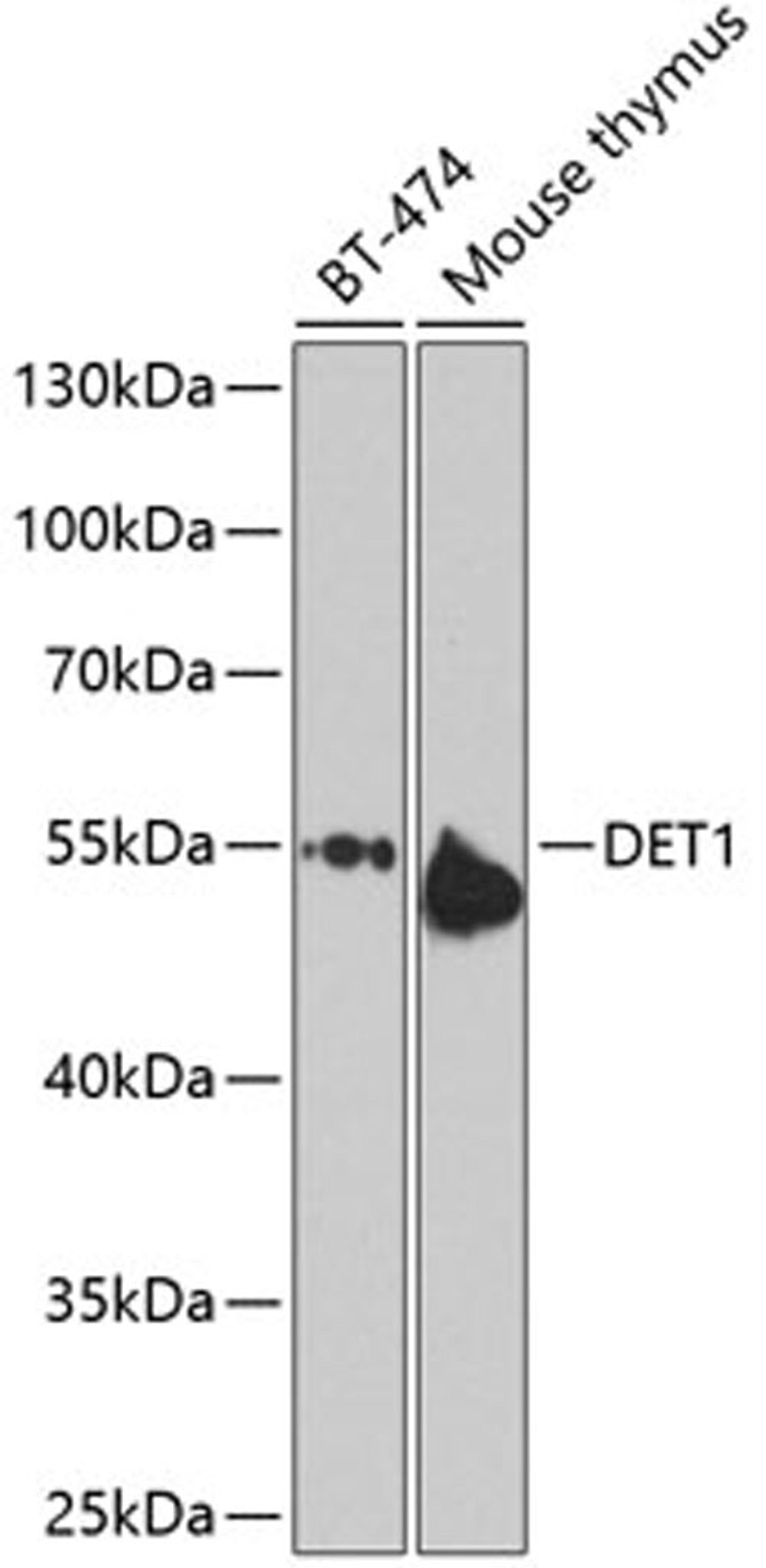 Western blot - DET1 antibody (A9974)