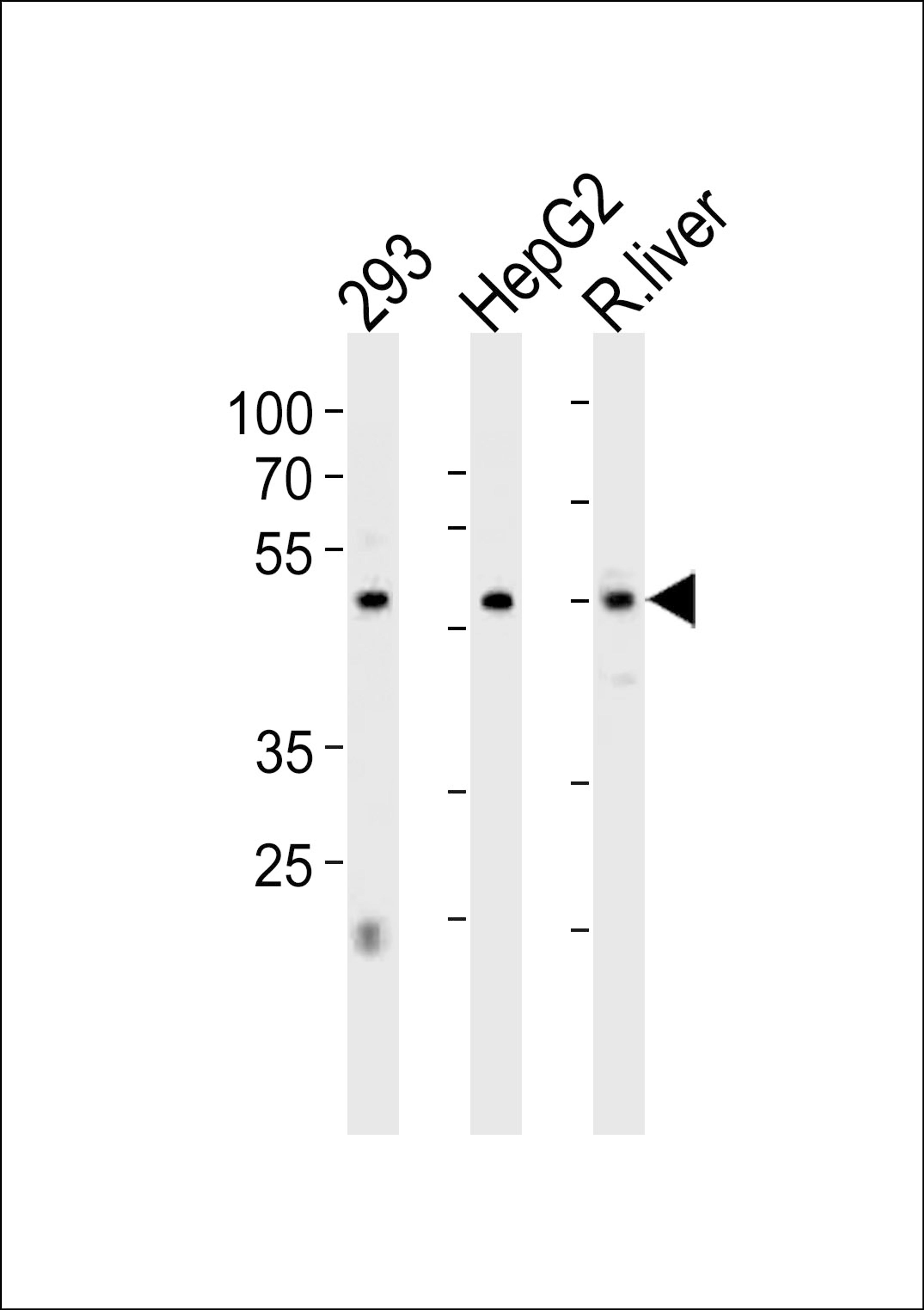 Western blot analysis in 293,HepG2 cell line and rat liver tissue lysates (35ug/lane).