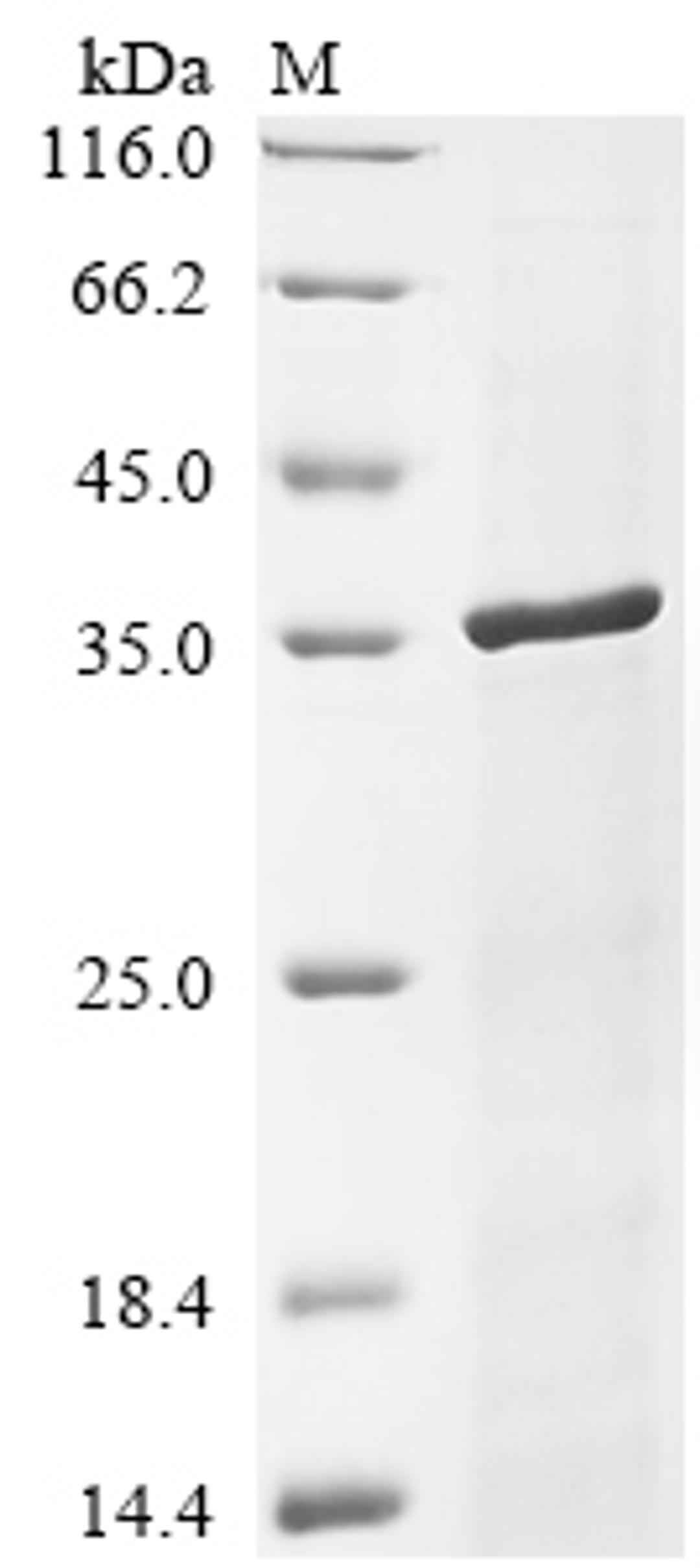 (Tris-Glycine gel) Discontinuous SDS-PAGE (reduced) with 5% enrichment gel and 15% separation gel.