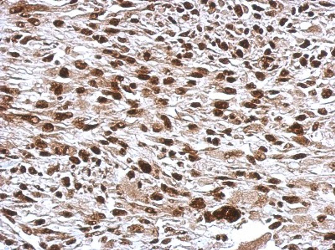 Immunohistochemistry-Paraffin: WBP11 Antibody [NBP2-20886] - Immunohistochemical analysis of paraffin-embedded C2C12 xenograft, using antibody at 1:500 dilution.