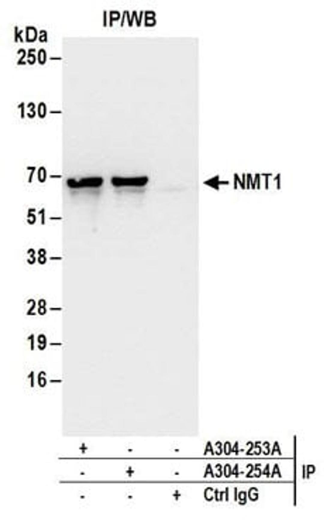 Detection of human NMT1 by western blot of immunoprecipitates.