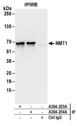 Detection of human NMT1 by western blot of immunoprecipitates.