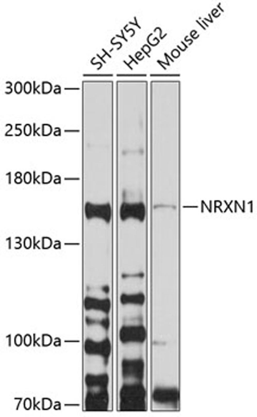 Western blot - NRXN1 antibody (A10066)