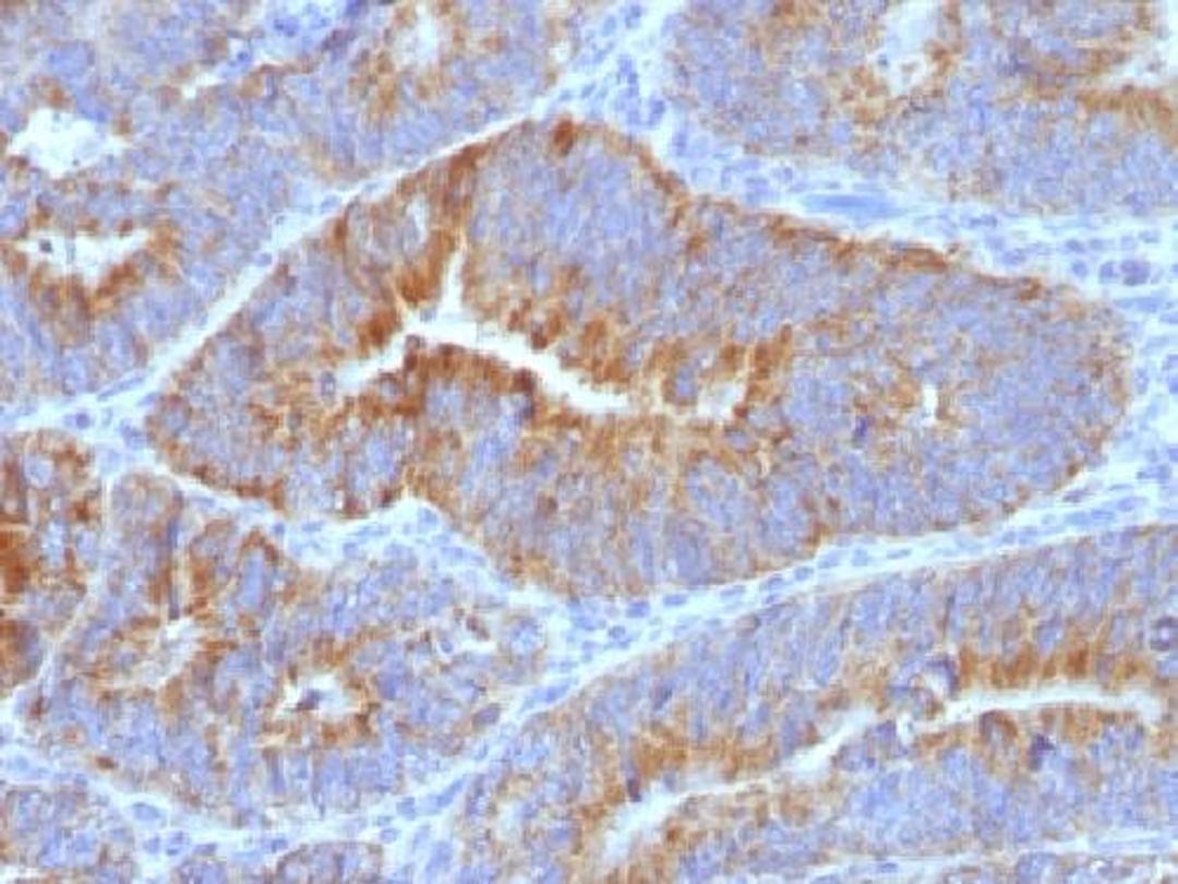 Immunohistochemical staining of CD176 antibody