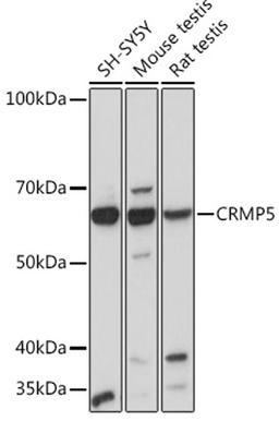 Western blot - CRMP5 Rabbit mAb (A3503)