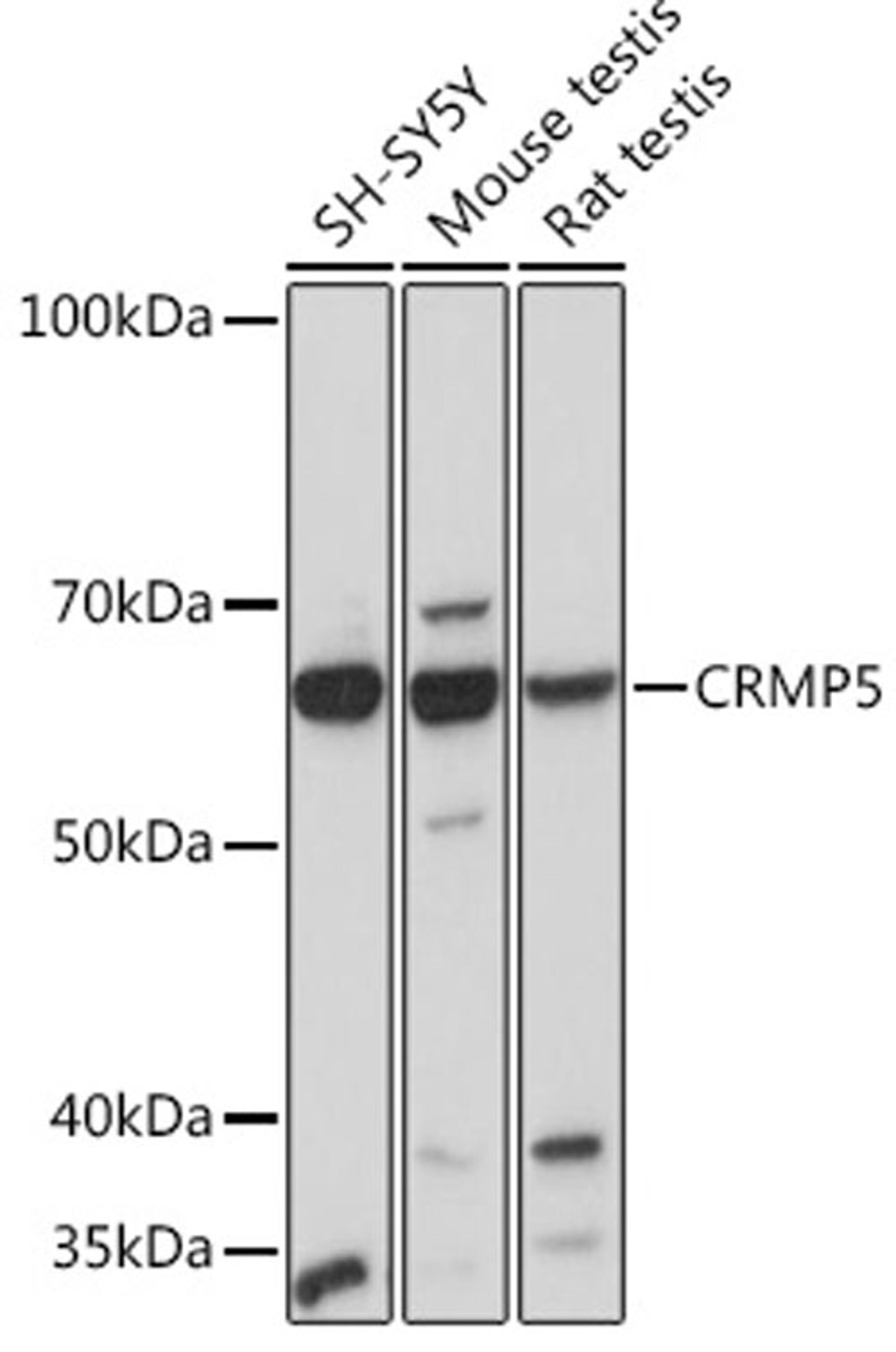 Western blot - CRMP5 Rabbit mAb (A3503)