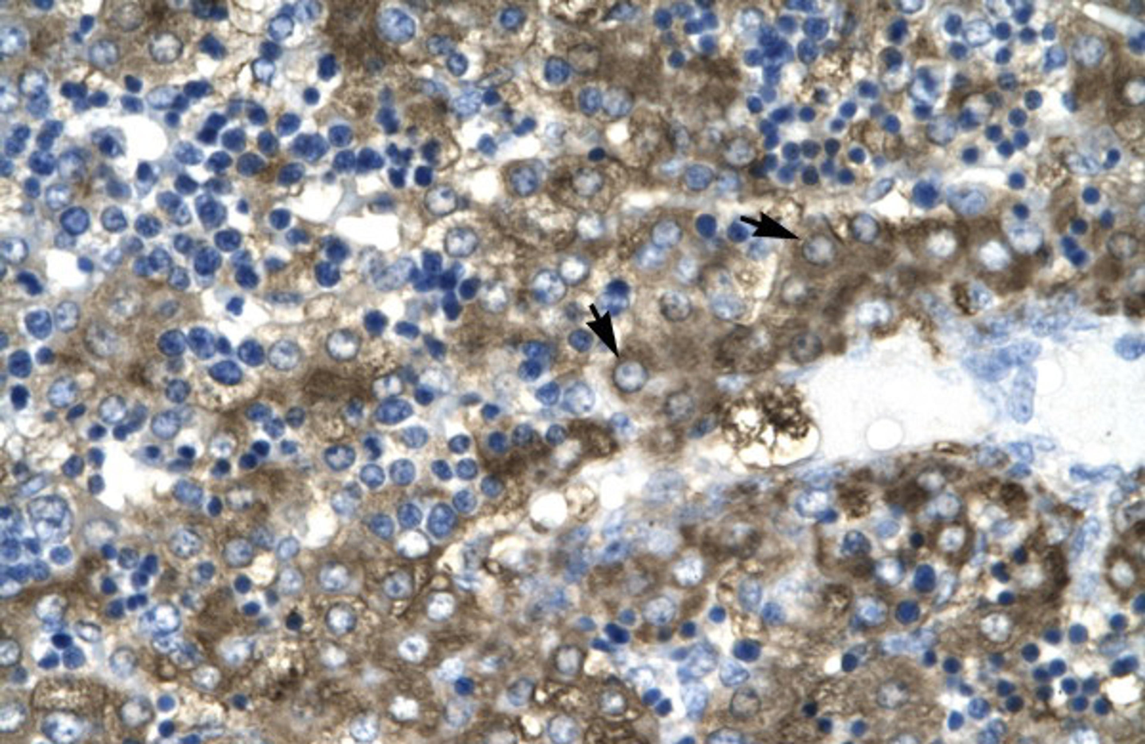 Antibody used in IHC on Human Liver cell lysates.