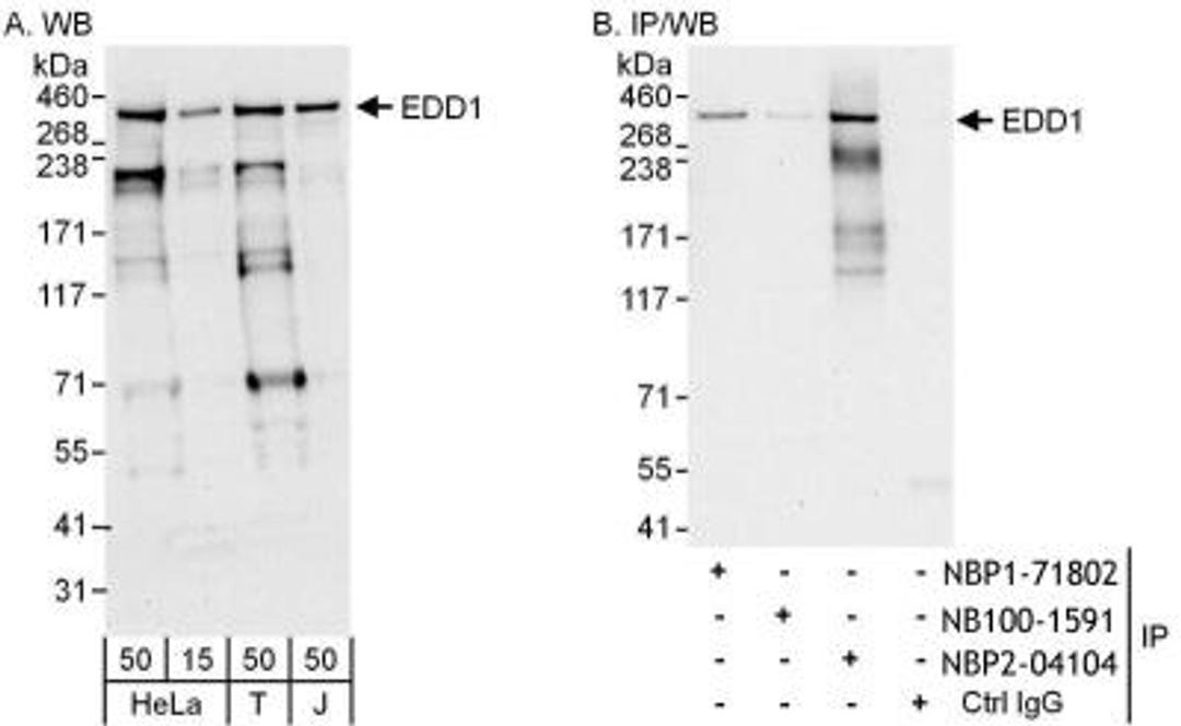 Immunoprecipitation: UBR5/EDD Antibody [NB100-1591] - Samples: Whole cell lysate from HeLa (15 and 50 ug for WB; 1 mg for IP, 20% of IP loaded), 293T (T; 50 ug) and Jurkat (J; 50 ug) cells. Antibodies: Affinity purified rabbit anti-EDD1 antibody NBP2-04104 used for WB at 0.4 ug/ml (A) and 1 ug/ml (B) and used for IP at 6 ug/mg lysate. EDD1 was also immunoprecipitated by rabbit anti-EDD1 antibodies NBP1-71802, which recognizes a downstream epitope, and NB100-1591, which recognizes a similar epitope. Detection: Chemiluminescence with exposure times of 10 seconds (A and B).