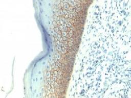 IHC testing of FFPE human skin with E-Cadherin antibody (clone SPM381). Required HIER: boil tissue sections in 10mM citrate buffer, pH 6.0, for 10-20 min.