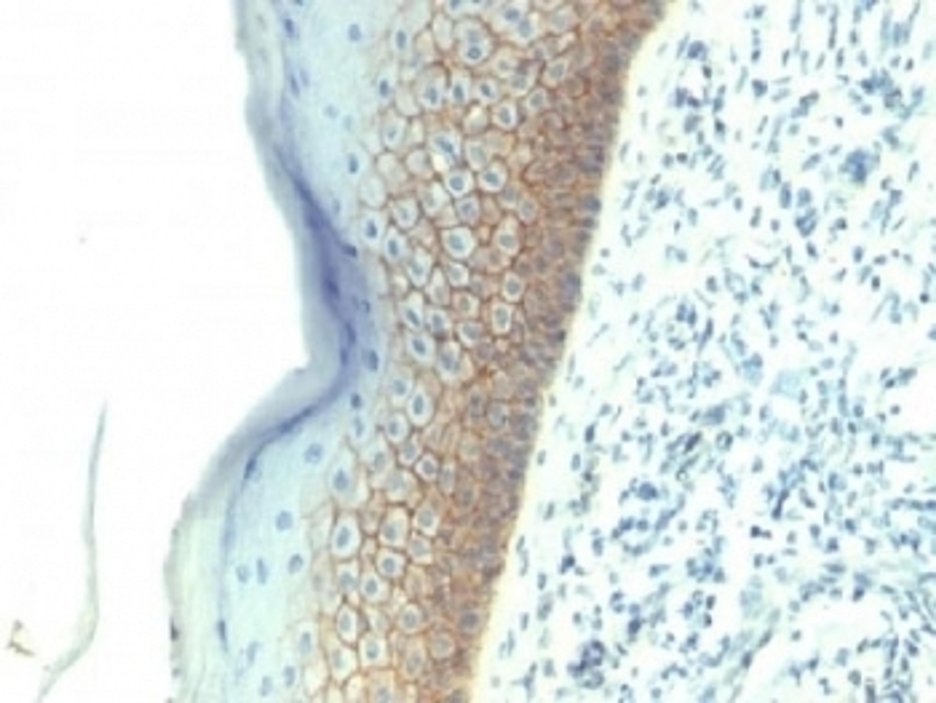 IHC testing of FFPE human skin with E-Cadherin antibody (clone SPM381). Required HIER: boil tissue sections in 10mM citrate buffer, pH 6.0, for 10-20 min.