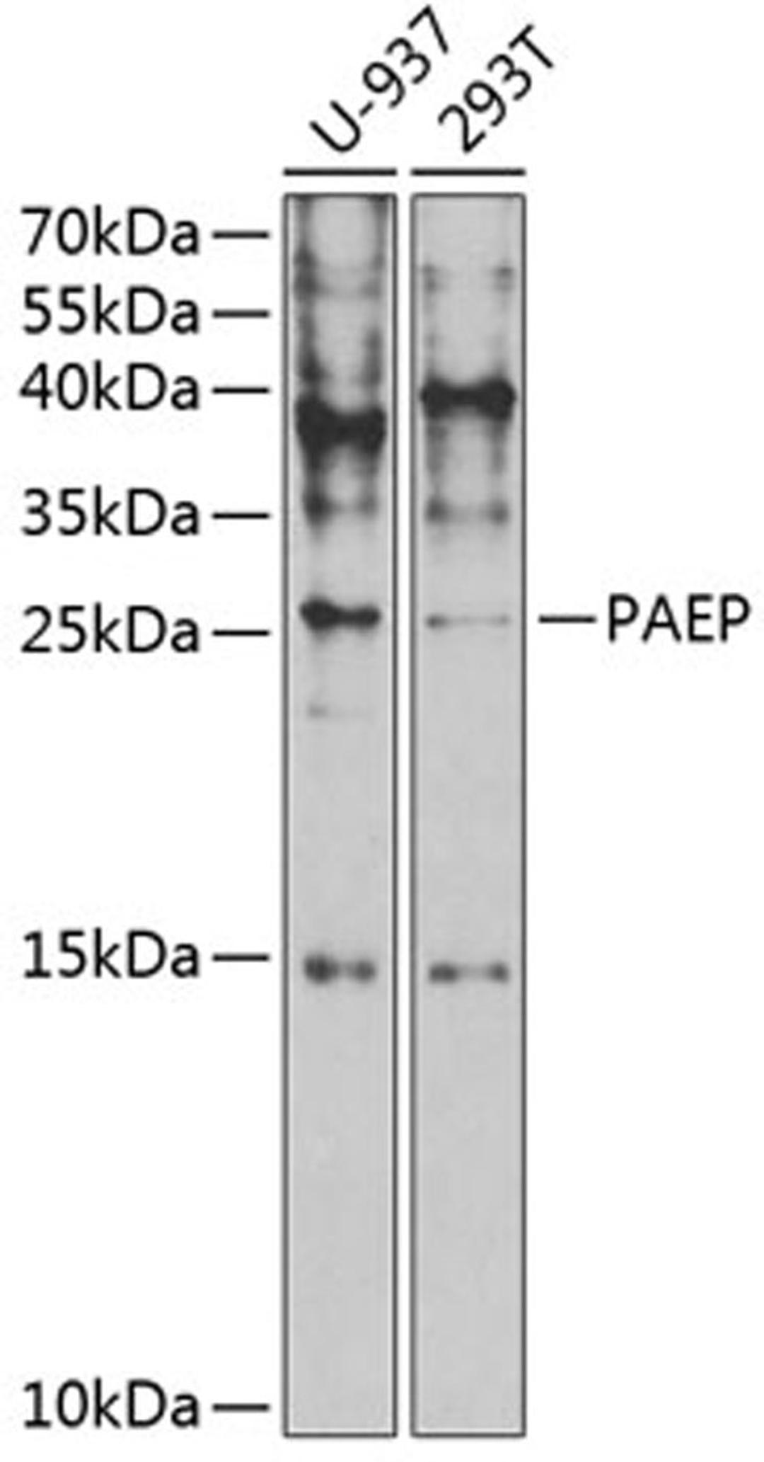 Western blot - PAEP antibody (A5751)