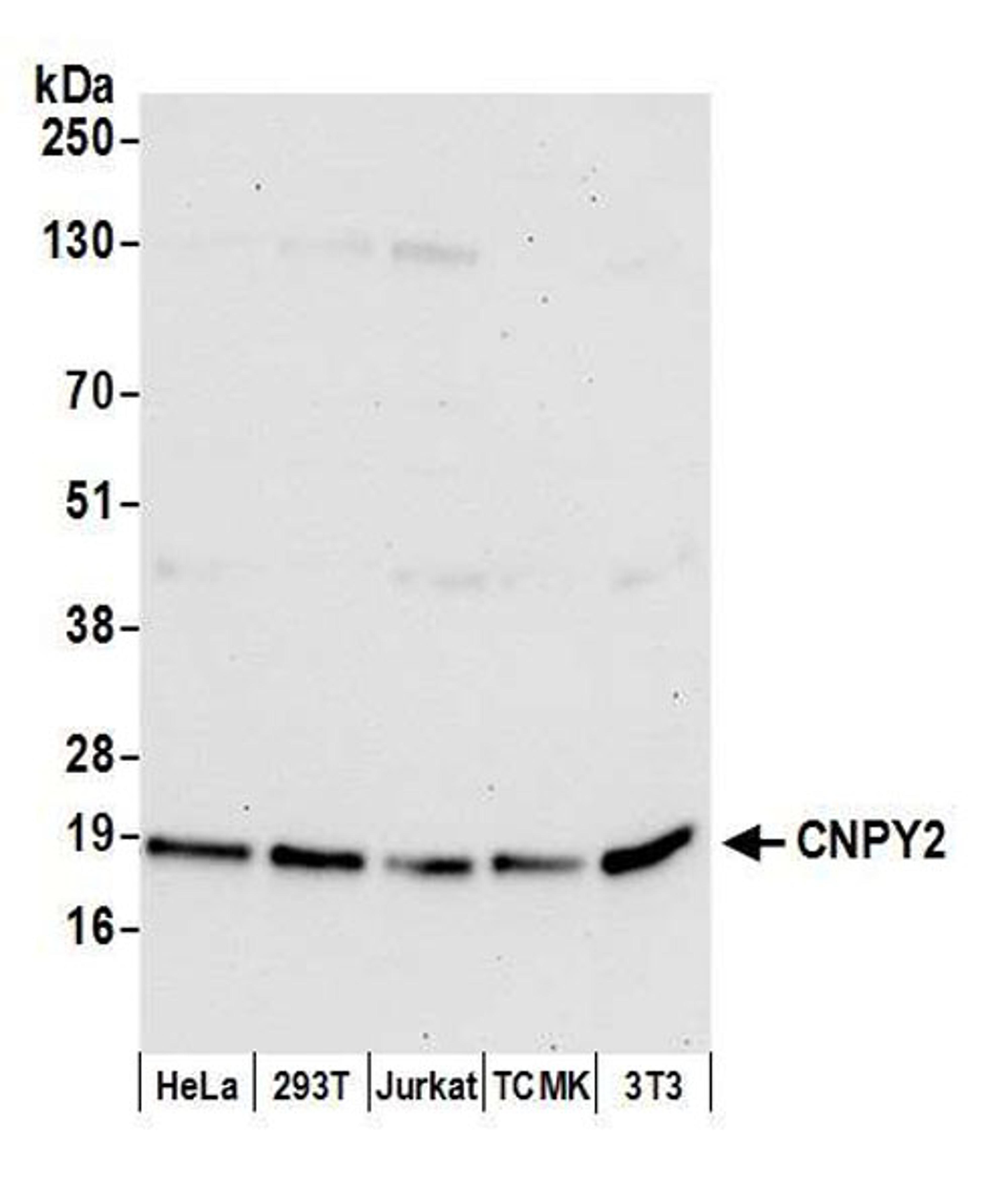 Detection of human and mouse CNPY2 by WB.