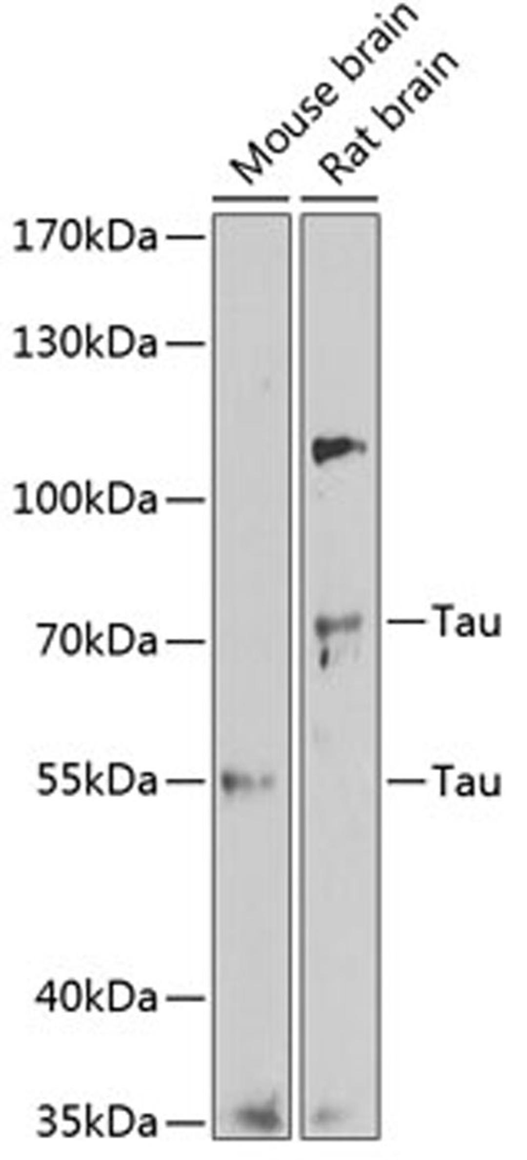 Western blot - Tau antibody (A1103)