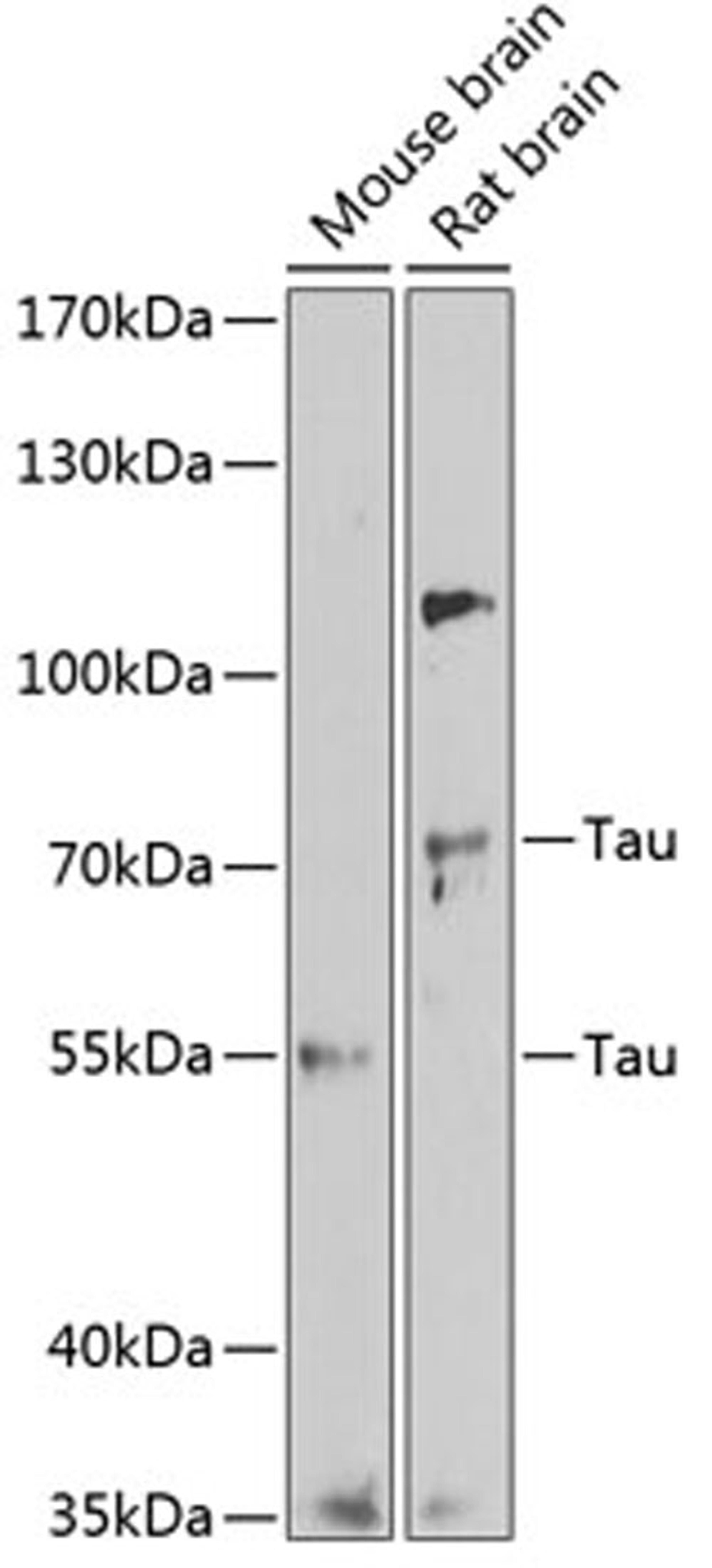 Western blot - Tau antibody (A1103)