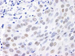 Detection of human MDC1 by immunohistochemistry.