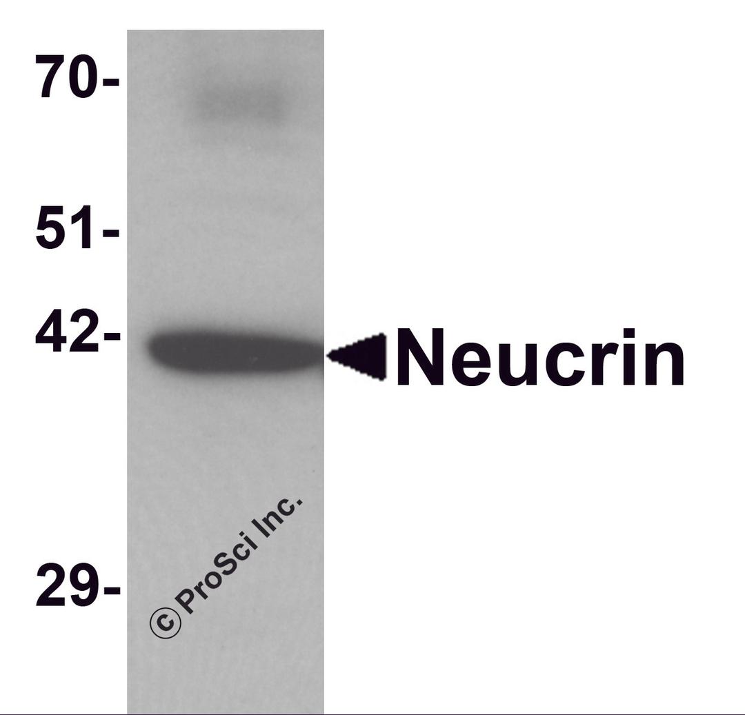 Western blot analysis of Neucrin in rat cerebellum tissue lysate with Neucrin antibody at 1 μg/mL.