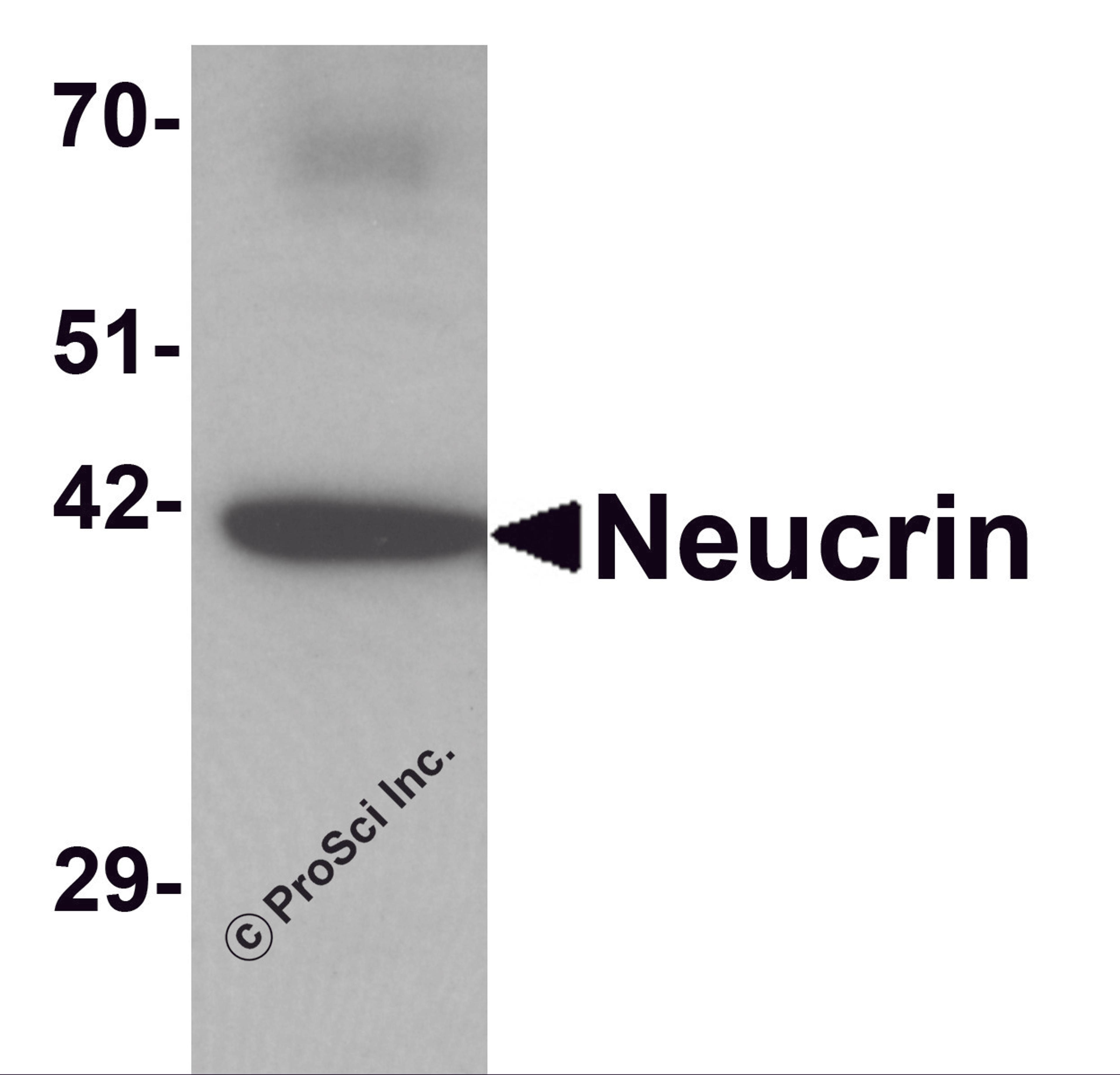 Western blot analysis of Neucrin in rat cerebellum tissue lysate with Neucrin antibody at 1 μg/mL.