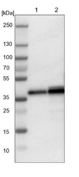 Western Blot: LASP1 Antibody [NBP1-82844] - Lane 1: NIH-3T3 cell lysate (Mouse embryonic fibroblast cells)<br/>Lane 2: NBT-II cell lysate (Rat Wistar bladder tumour cells)