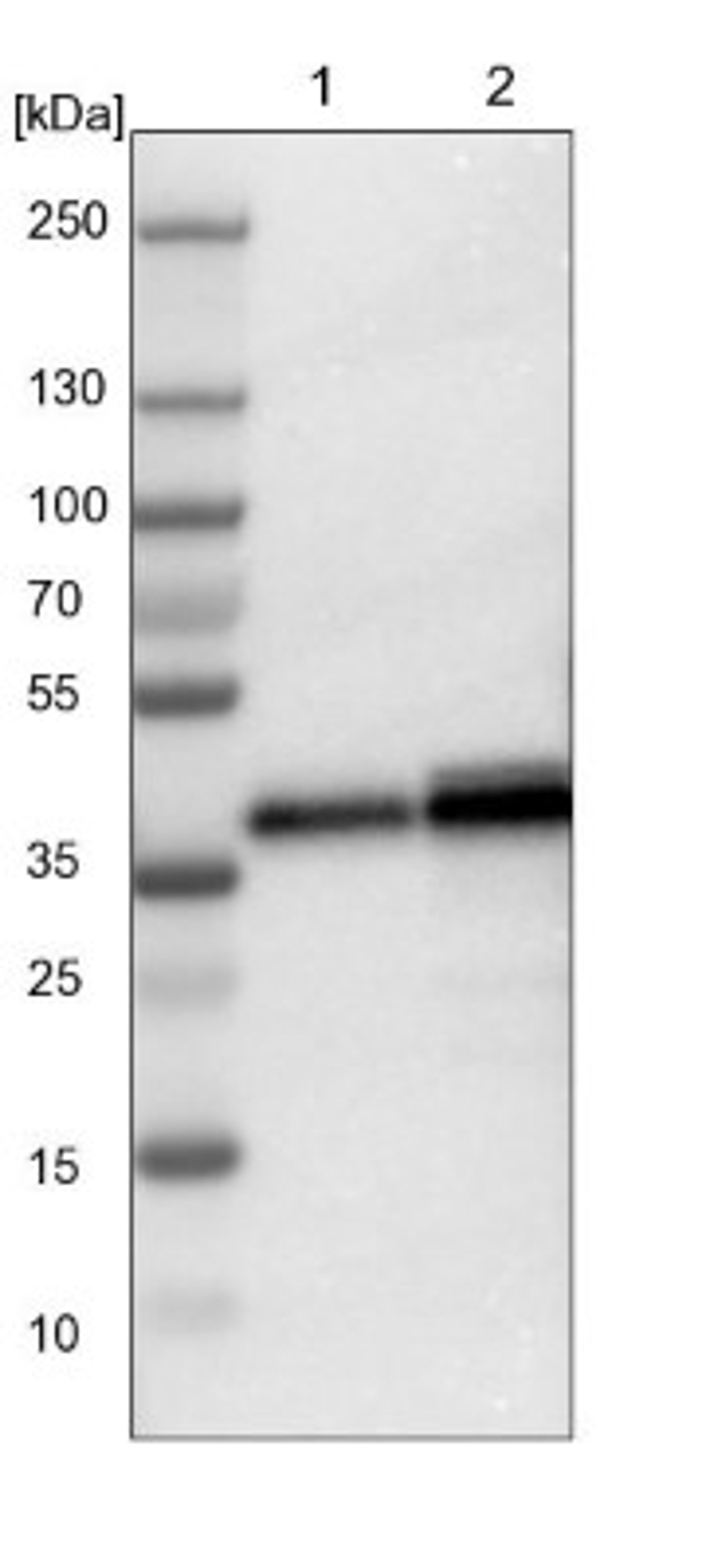 Western Blot: LASP1 Antibody [NBP1-82844] - Lane 1: NIH-3T3 cell lysate (Mouse embryonic fibroblast cells)<br/>Lane 2: NBT-II cell lysate (Rat Wistar bladder tumour cells)