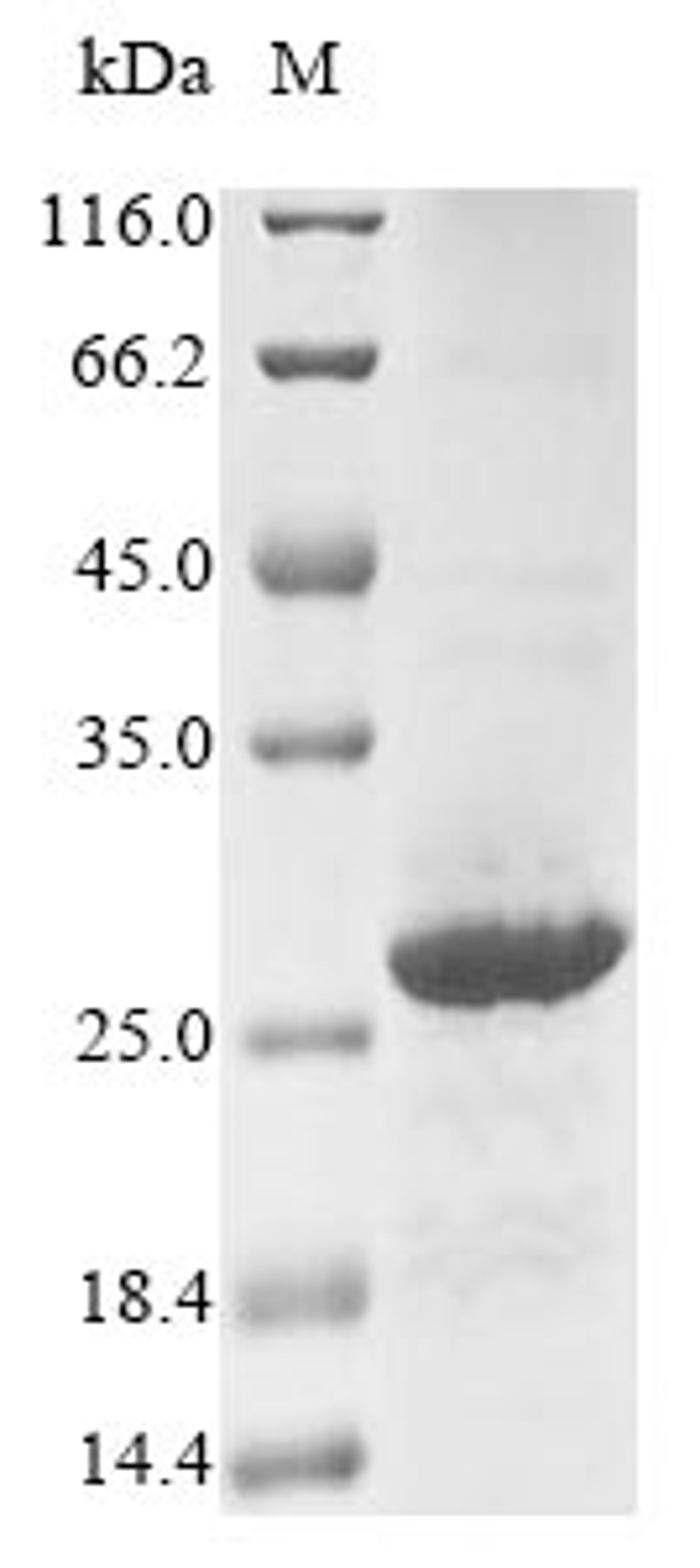 (Tris-Glycine gel) Discontinuous SDS-PAGE (reduced) with 5% enrichment gel and 15% separation gel.