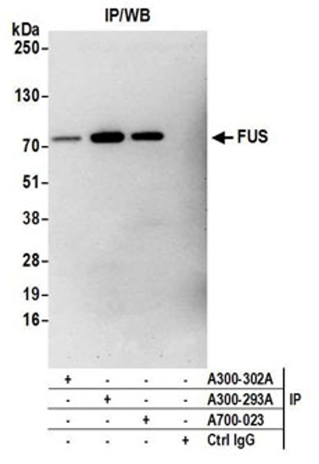 Detection of human FUS by western blot of immunoprecipitates.