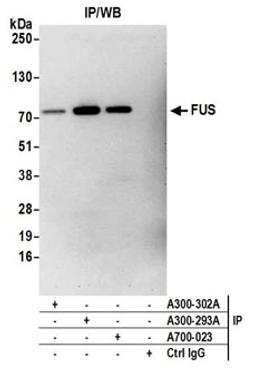 Detection of human FUS by western blot of immunoprecipitates.