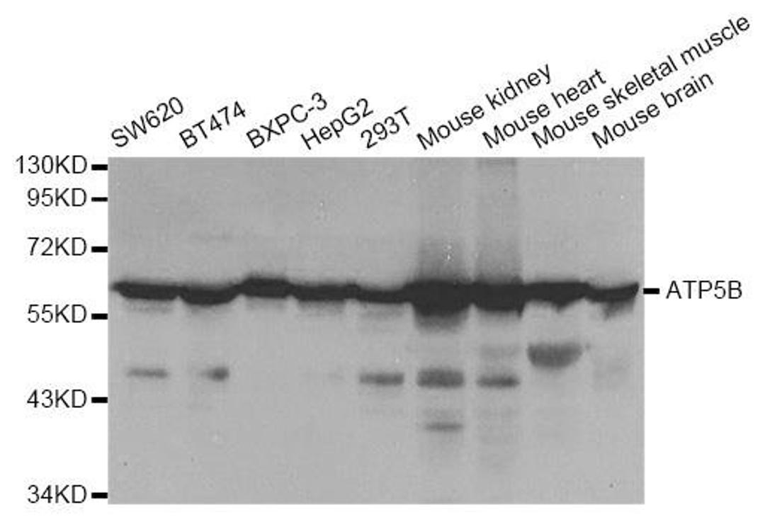 Western blot analysis of extracts of various cell lines using ATP5B antibody