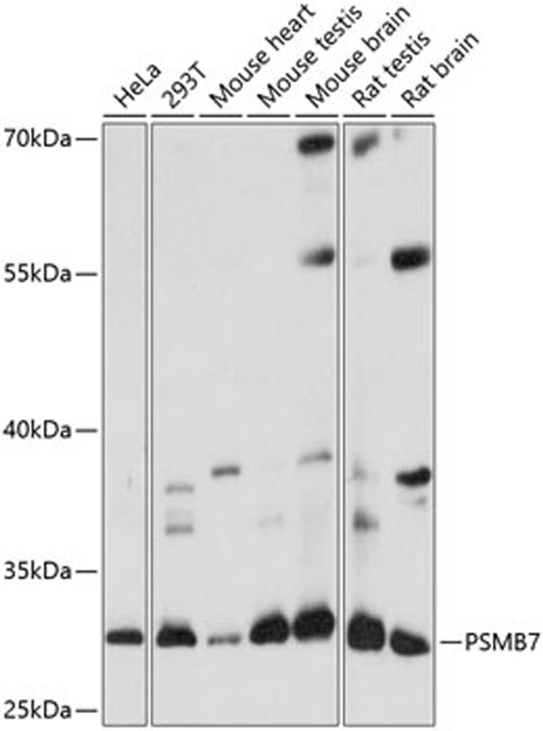 Western blot - PSMB7 antibody (A14771)