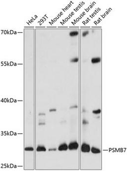 Western blot - PSMB7 antibody (A14771)