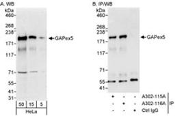 Detection of human GAPex5 by western blot and immunoprecipitation.