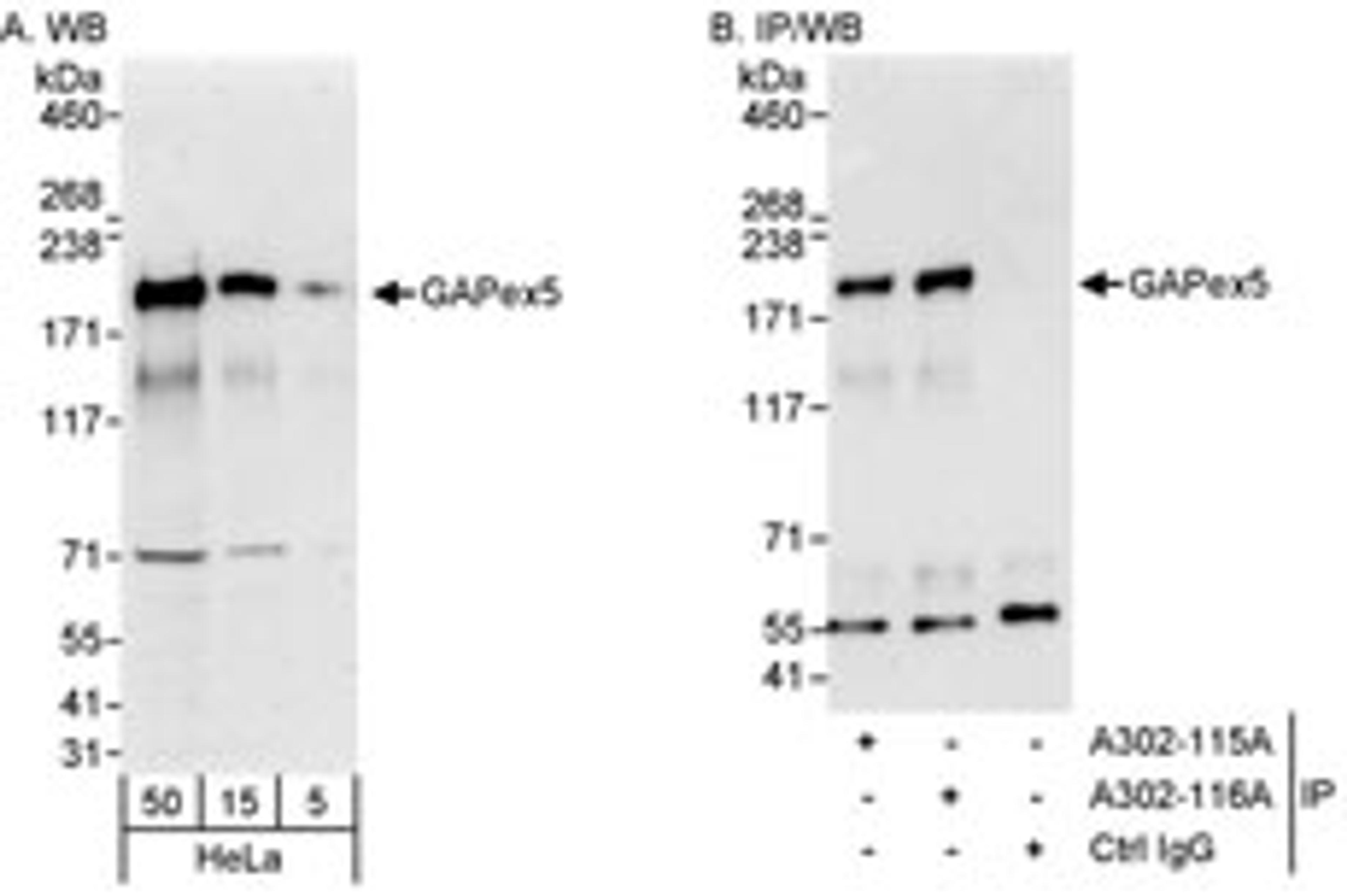 Detection of human GAPex5 by western blot and immunoprecipitation.