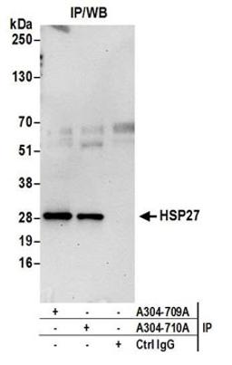 Detection of human HSP27 by western blot of immunoprecipitates.