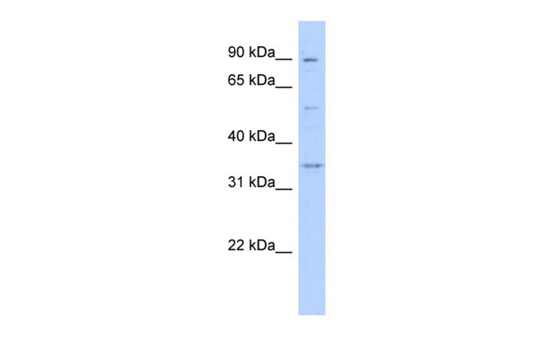 Antibody used in WB on Transfected 293T at 0.2-1 ug/ml.