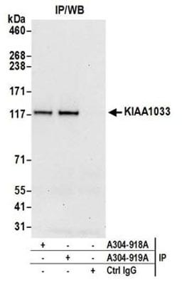 Detection of human KIAA1033 by western blot of immunoprecipitates.