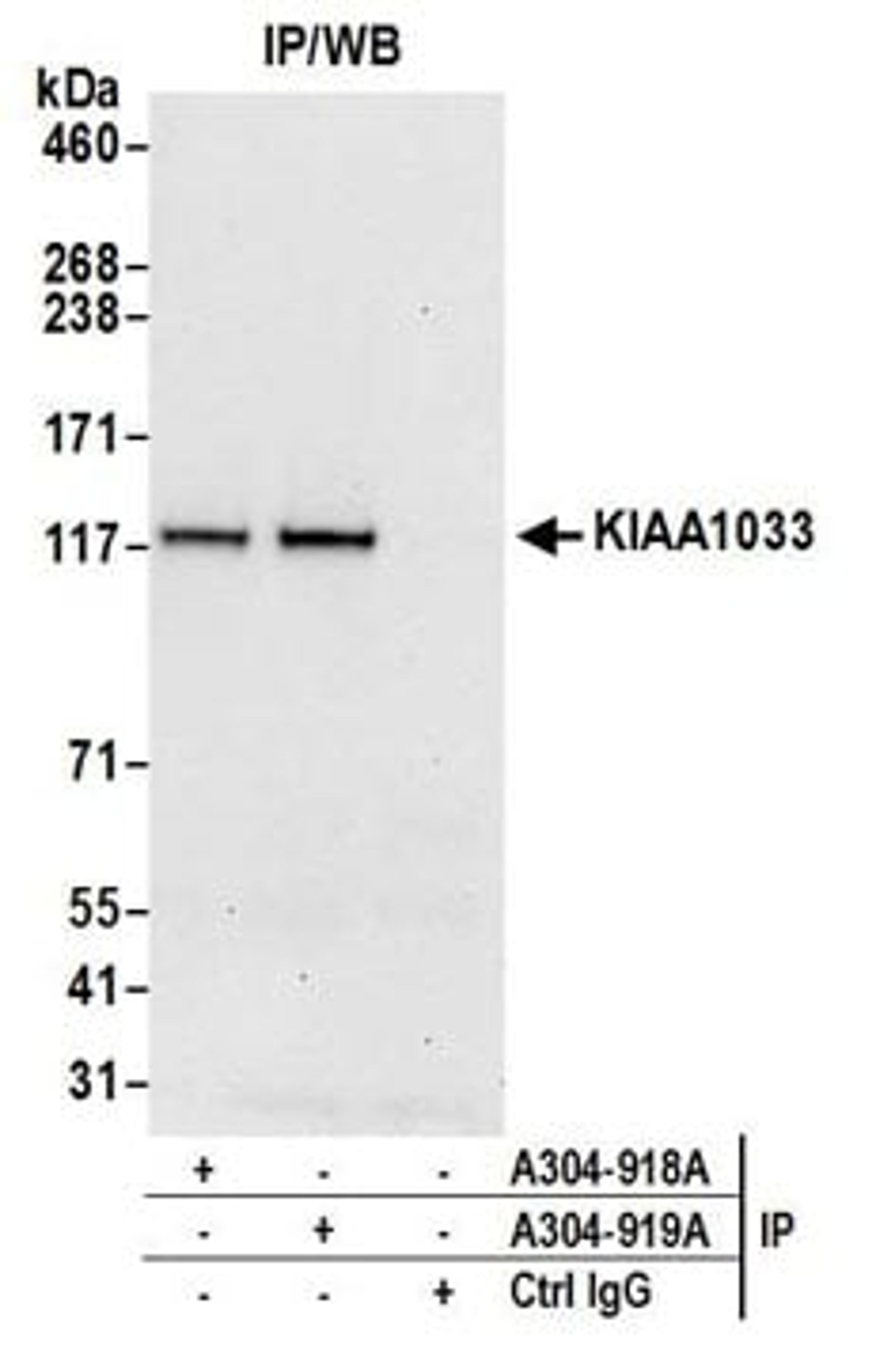 Detection of human KIAA1033 by western blot of immunoprecipitates.