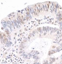 Detection of human MYBBP1A by immunohistochemistry.