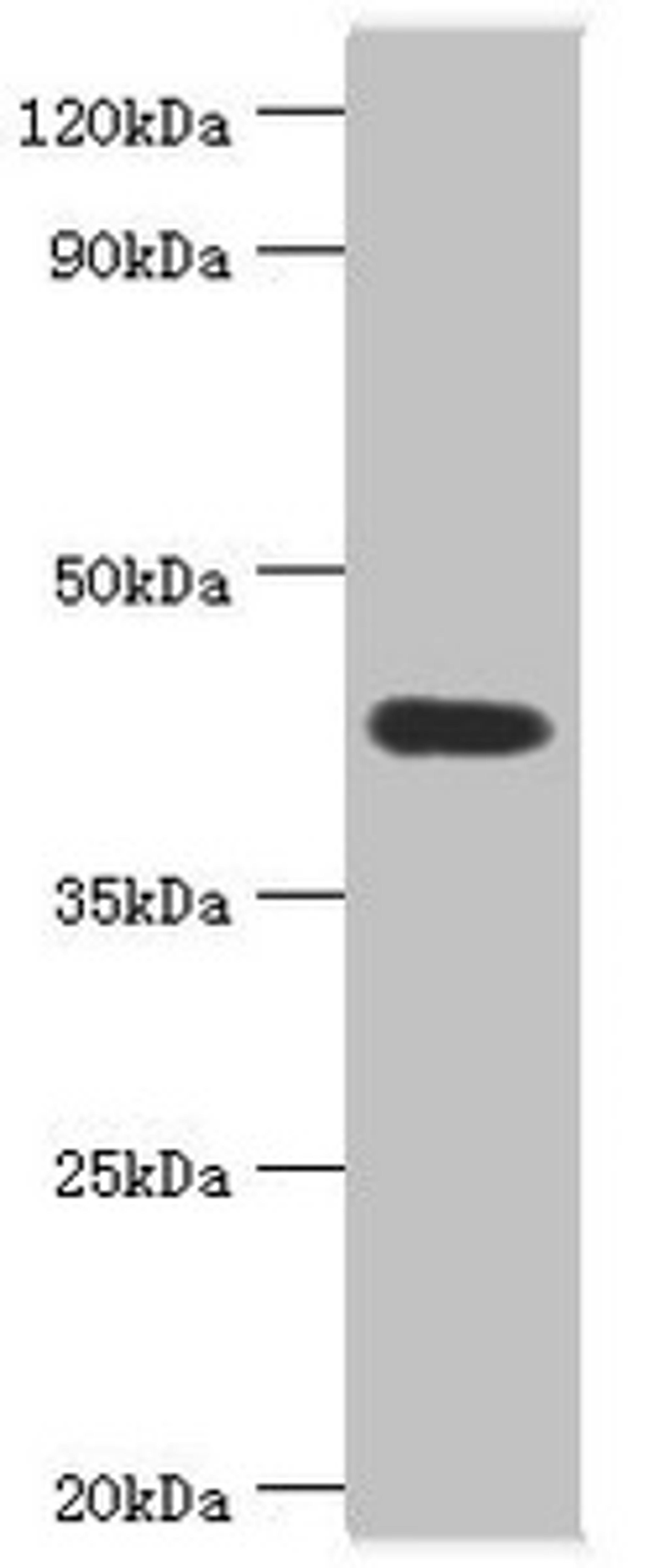 Western blot. All lanes: Acid ceramidase antibody at 6ug/ml + Mouse heart tissue. Secondary. Goat polyclonal to rabbit IgG at 1/10000 dilution. Predicted band size: 45, 47 kDa. Observed band size: 45 kDa. 