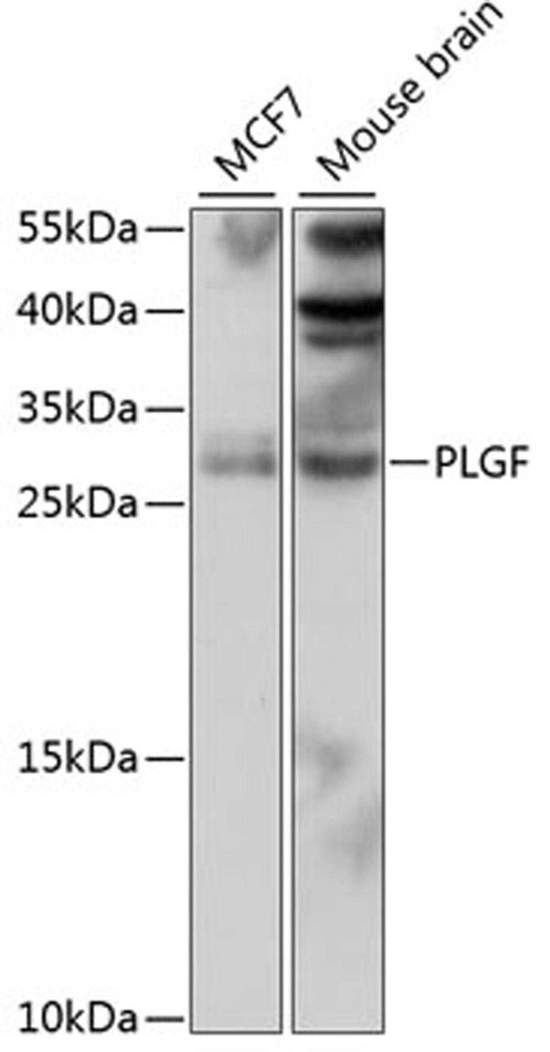 Western blot - PLGF antibody (A16257)