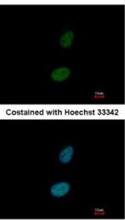 Immunocytochemistry/Immunofluorescence: ZNF133 Antibody [NBP2-20963] - Analysis of paraformaldehyde-fixed HeLa, using antibody at 1:200 dilution.