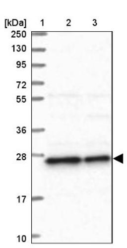 Western Blot: REXO2 Antibody [NBP1-85666] - Lane 1: Marker [kDa] 250, 130, 95, 72, 55, 36, 28, 17, 10<br/>Lane 2: Human cell line RT-4<br/>Lane 3: Human cell line U-251MG sp