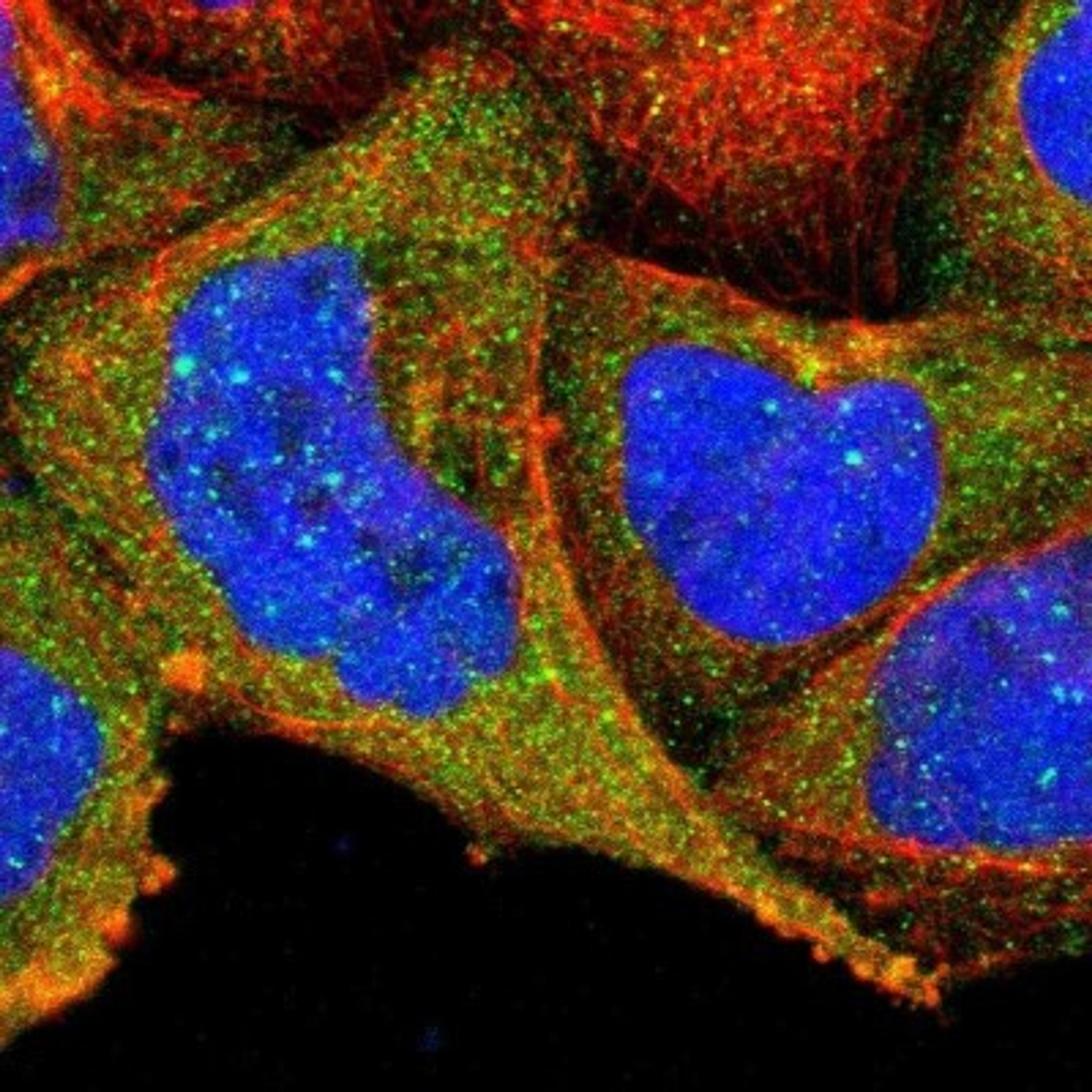 Immunocytochemistry/Immunofluorescence: ODF2 Antibody [NBP1-85417] - Staining of human cell line A-431 shows positivity in cytoplasm.