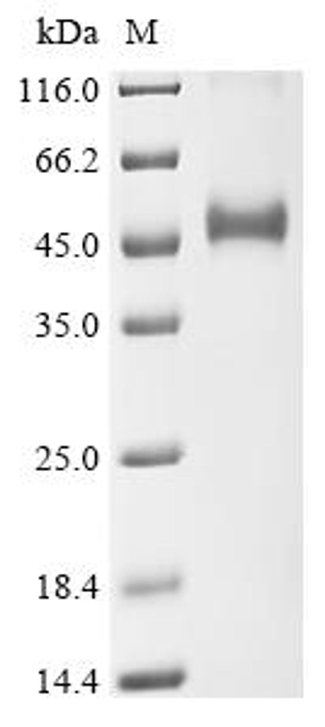 (Tris-Glycine gel) Discontinuous SDS-PAGE (reduced) with 5% enrichment gel and 15% separation gel.