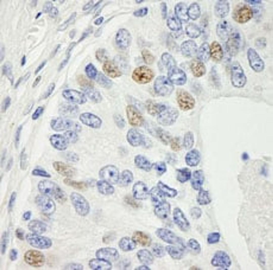 Detection of human MAD1 by immunohistochemistry.