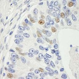 Detection of human MAD1 by immunohistochemistry.