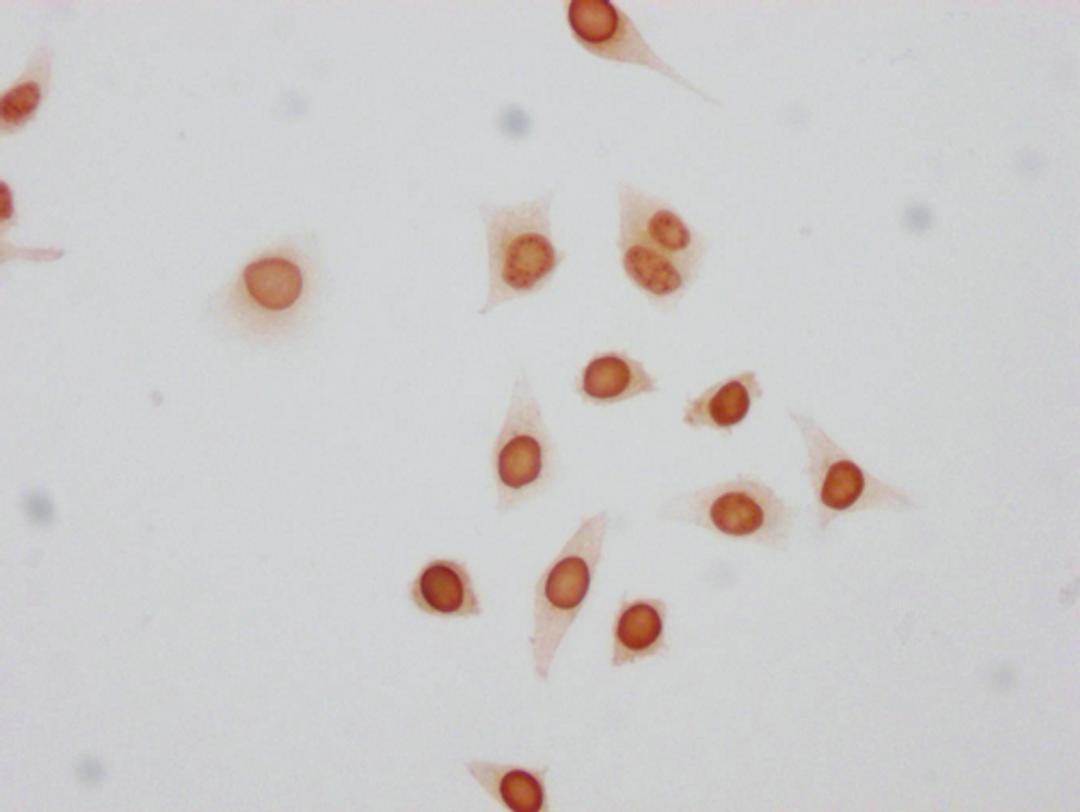 Immunocytochemistry analysis of CSB-PA010380PA17phHU diluted at 1:50 and staining in Hela cells(treated with 50nM Calyculin A for 30min) performed on a Leica BondTM system. The cells were fixed in 4% formaldehyde, permeabilized using 0.2% Triton X-100 and blocked with 10% normal goat serum 30min at RT. Then primary antibody (1% BSA) was incubated at 4°C overnight. The primary is detected by a biotinylated secondary antibody and visualized using an HRP conjugated SP system.