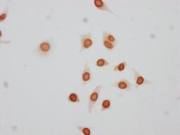 Immunocytochemistry analysis of CSB-PA010380PA17phHU diluted at 1:50 and staining in Hela cells(treated with 50nM Calyculin A for 30min) performed on a Leica BondTM system. The cells were fixed in 4% formaldehyde, permeabilized using 0.2% Triton X-100 and blocked with 10% normal goat serum 30min at RT. Then primary antibody (1% BSA) was incubated at 4°C overnight. The primary is detected by a biotinylated secondary antibody and visualized using an HRP conjugated SP system.