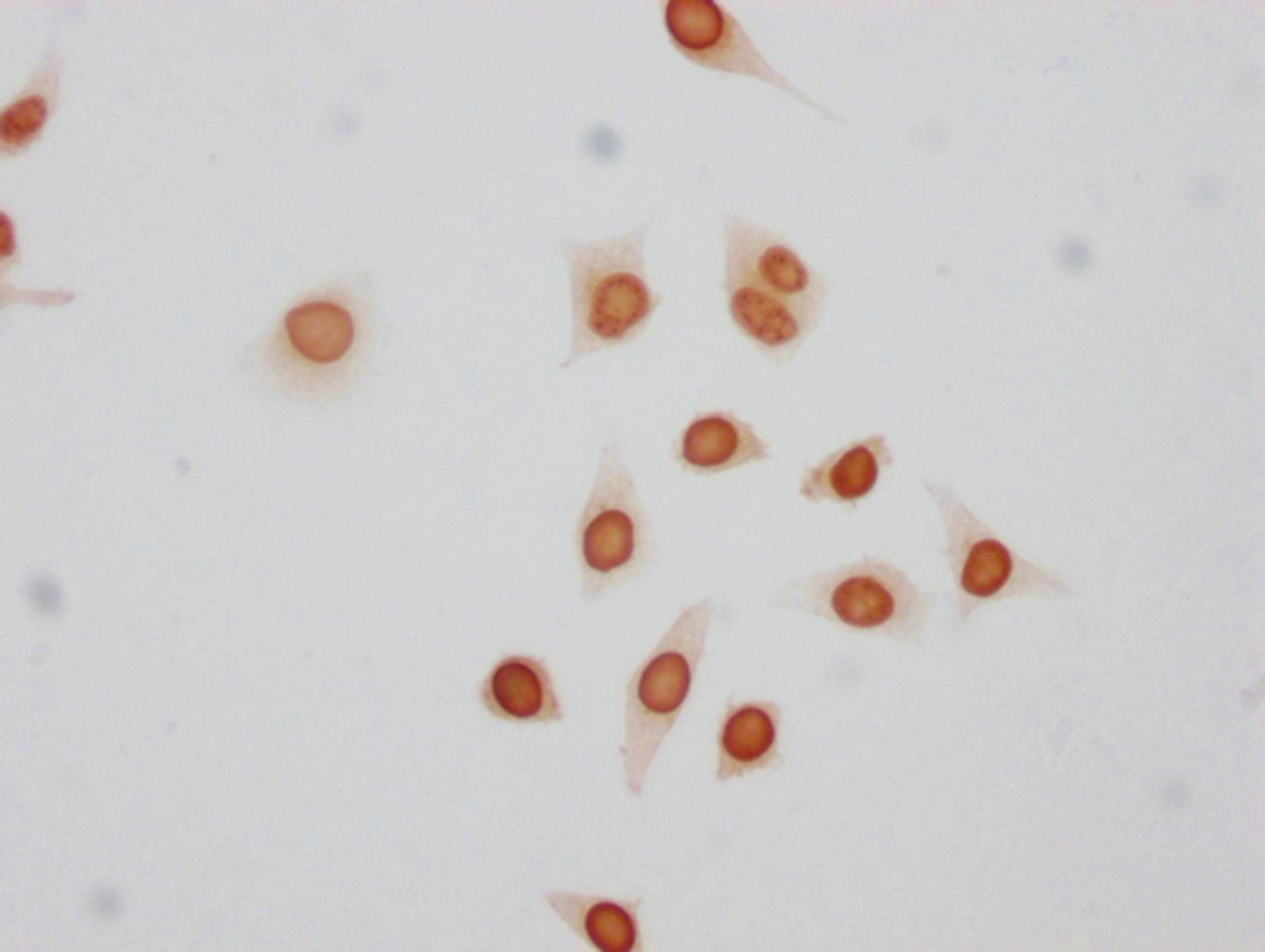 Immunocytochemistry analysis of CSB-PA010380PA17phHU diluted at 1:50 and staining in Hela cells(treated with 50nM Calyculin A for 30min) performed on a Leica BondTM system. The cells were fixed in 4% formaldehyde, permeabilized using 0.2% Triton X-100 and blocked with 10% normal goat serum 30min at RT. Then primary antibody (1% BSA) was incubated at 4°C overnight. The primary is detected by a biotinylated secondary antibody and visualized using an HRP conjugated SP system.