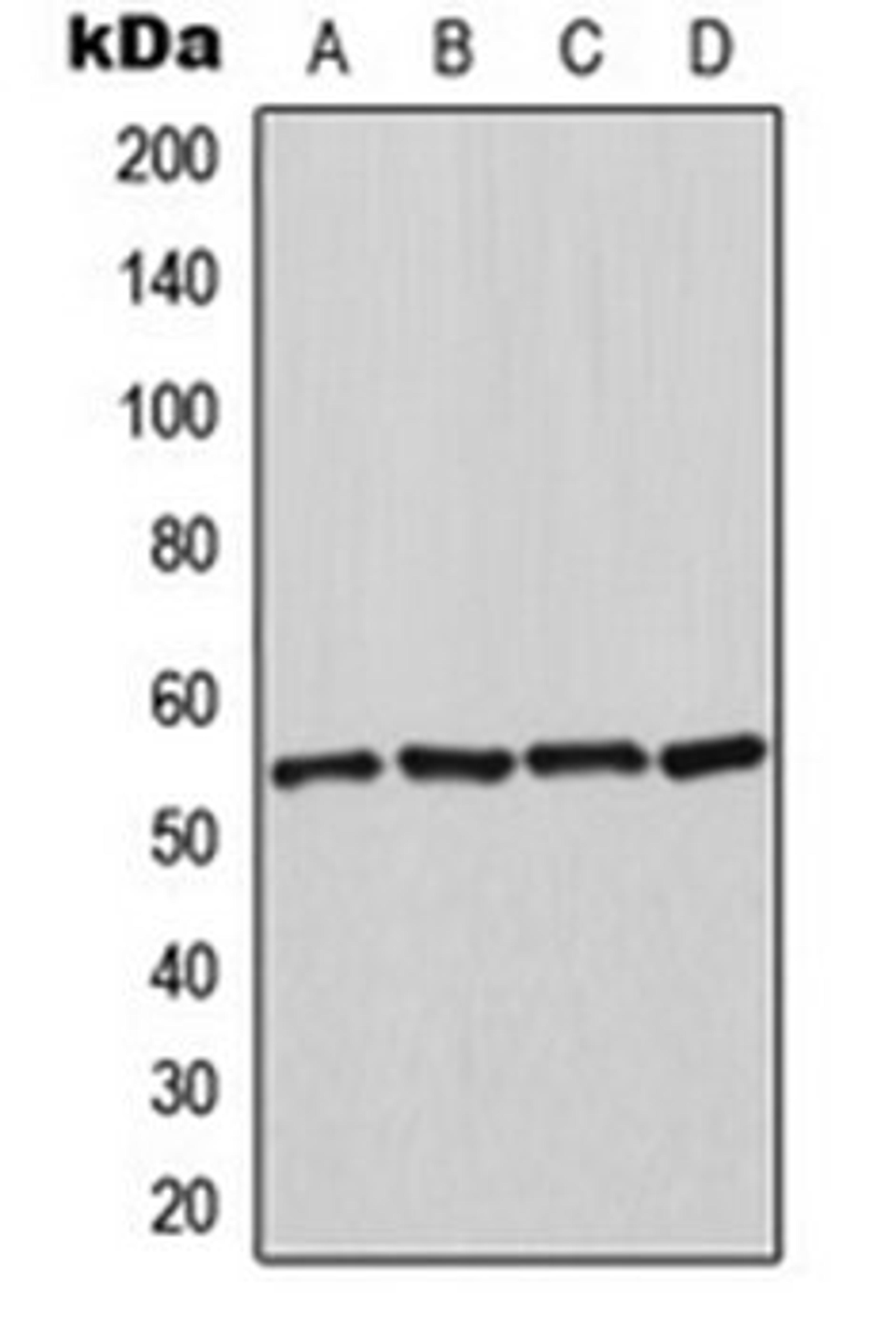 Western blot analysis of K562 (Lane 1), HeLa (Lane 2), NIH3T3 (Lane 3), rat kidney (Lane 4) whole cell lysates using HSPA14 antibody